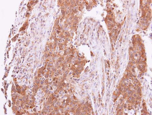 ACK1 Antibody in Immunohistochemistry (Paraffin) (IHC (P))