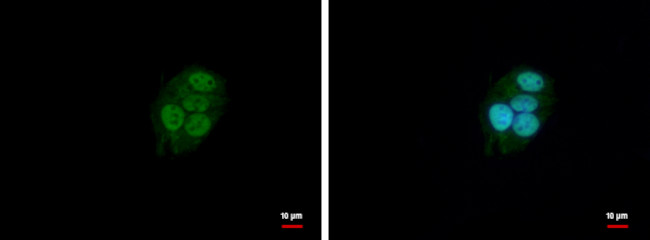 BAF57 Antibody in Immunocytochemistry (ICC/IF)