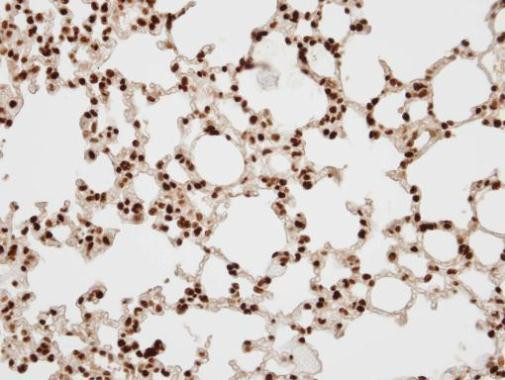 BAF57 Antibody in Immunohistochemistry (Paraffin) (IHC (P))