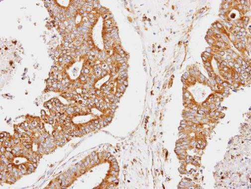 CCNDBP1 Antibody in Immunohistochemistry (Paraffin) (IHC (P))