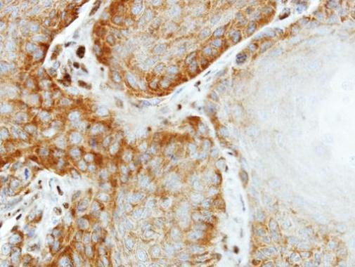 eIF2 beta Antibody in Immunohistochemistry (Paraffin) (IHC (P))