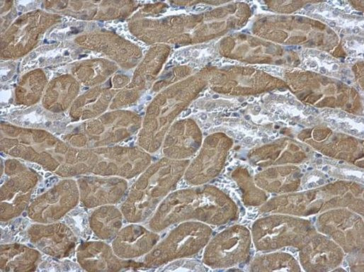 eIF2 beta Antibody in Immunohistochemistry (Paraffin) (IHC (P))