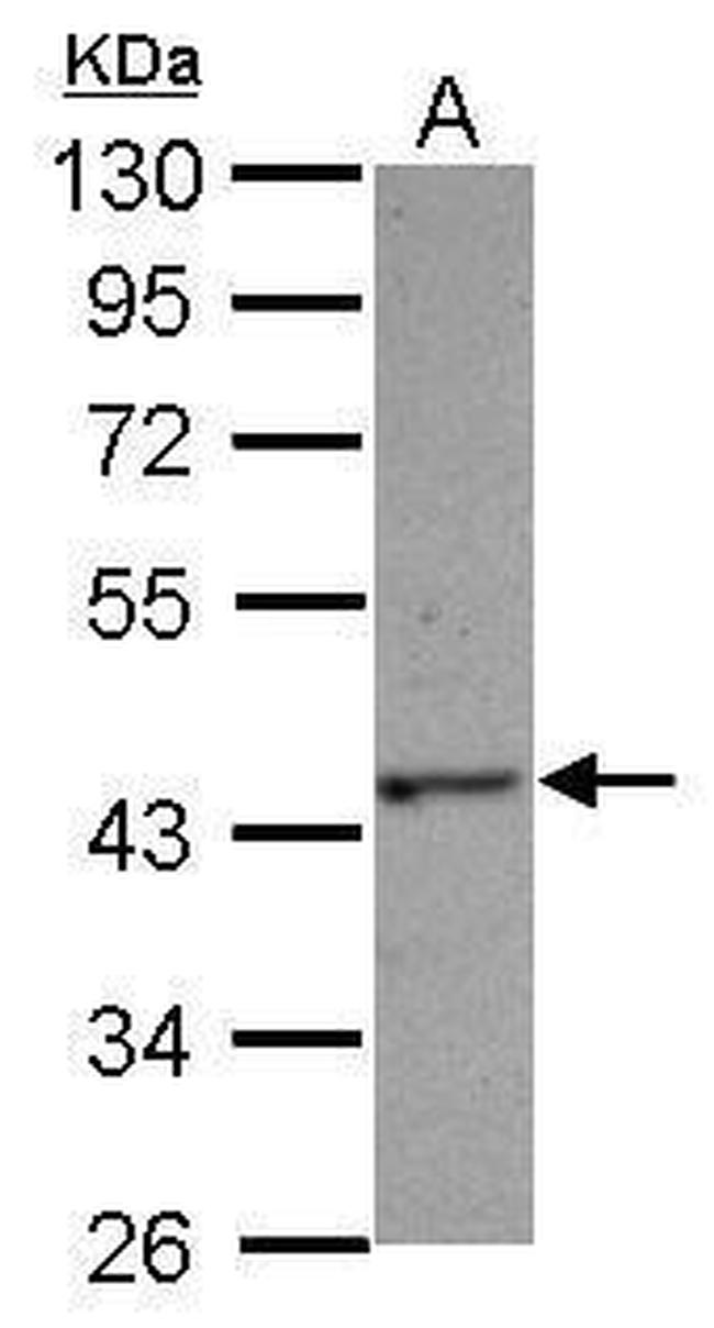 HAUS4 Antibody in Western Blot (WB)