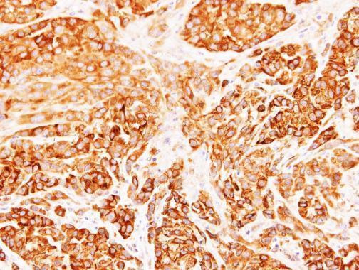 DIABLO Antibody in Immunohistochemistry (Paraffin) (IHC (P))