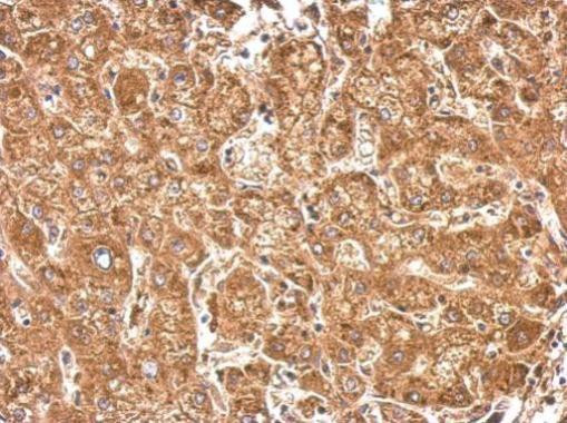 HACL1 Antibody in Immunohistochemistry (Paraffin) (IHC (P))