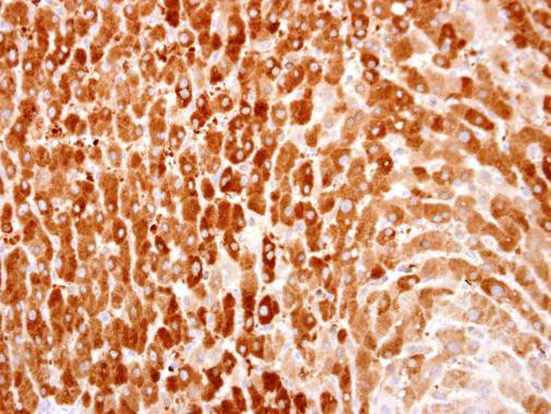 HACL1 Antibody in Immunohistochemistry (Paraffin) (IHC (P))