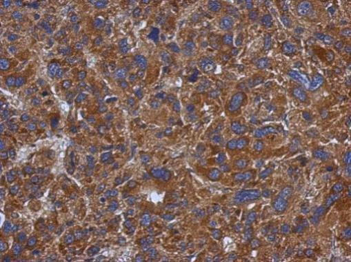 TXNDC5 Antibody in Immunohistochemistry (Paraffin) (IHC (P))