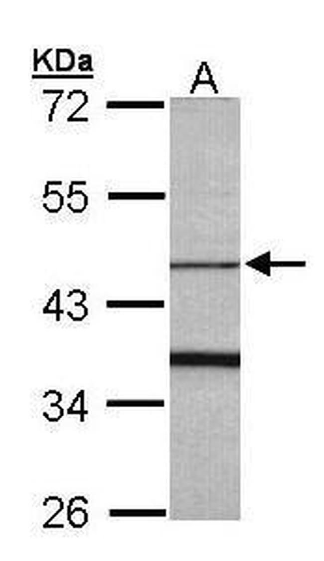 FBXO15 Antibody in Western Blot (WB)