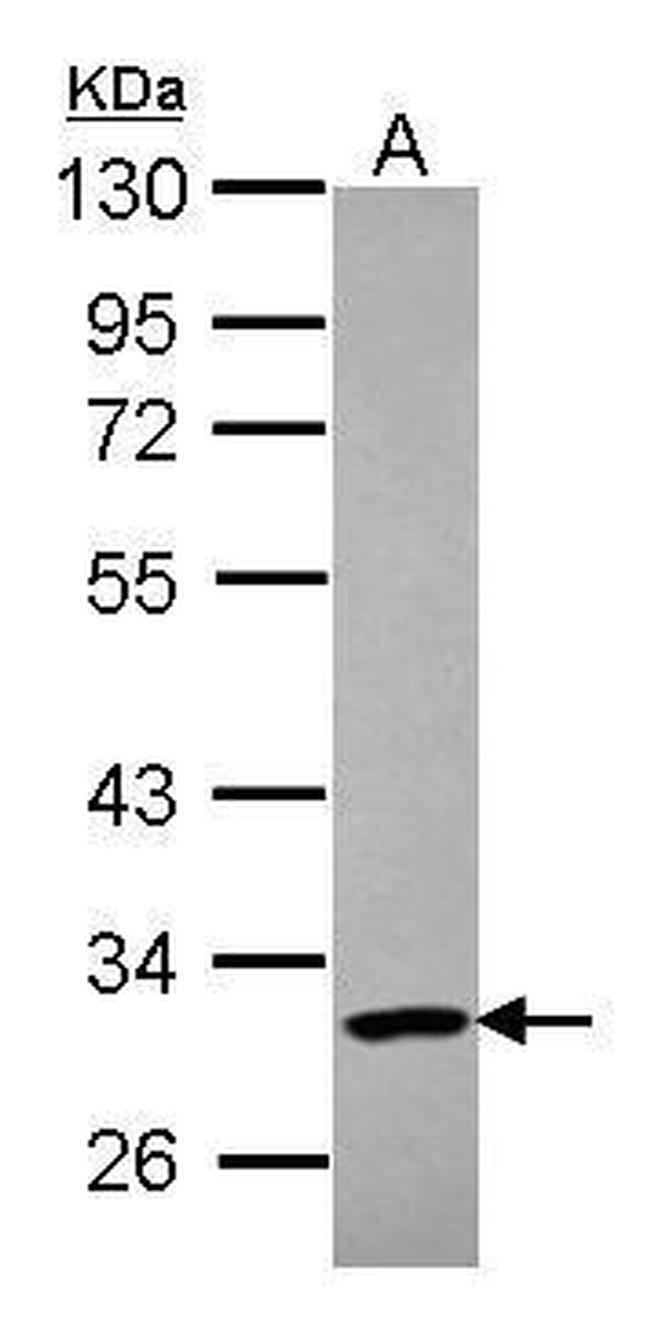 PARP11 Antibody in Western Blot (WB)