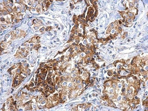 FGFR1 Antibody in Immunohistochemistry (Paraffin) (IHC (P))