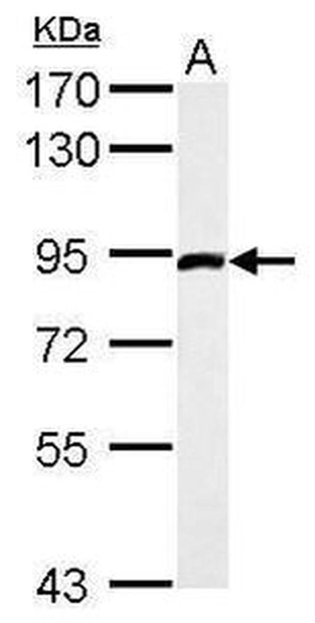 FGFR1 Antibody in Western Blot (WB)