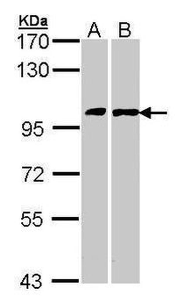 FGFR1 Antibody in Western Blot (WB)