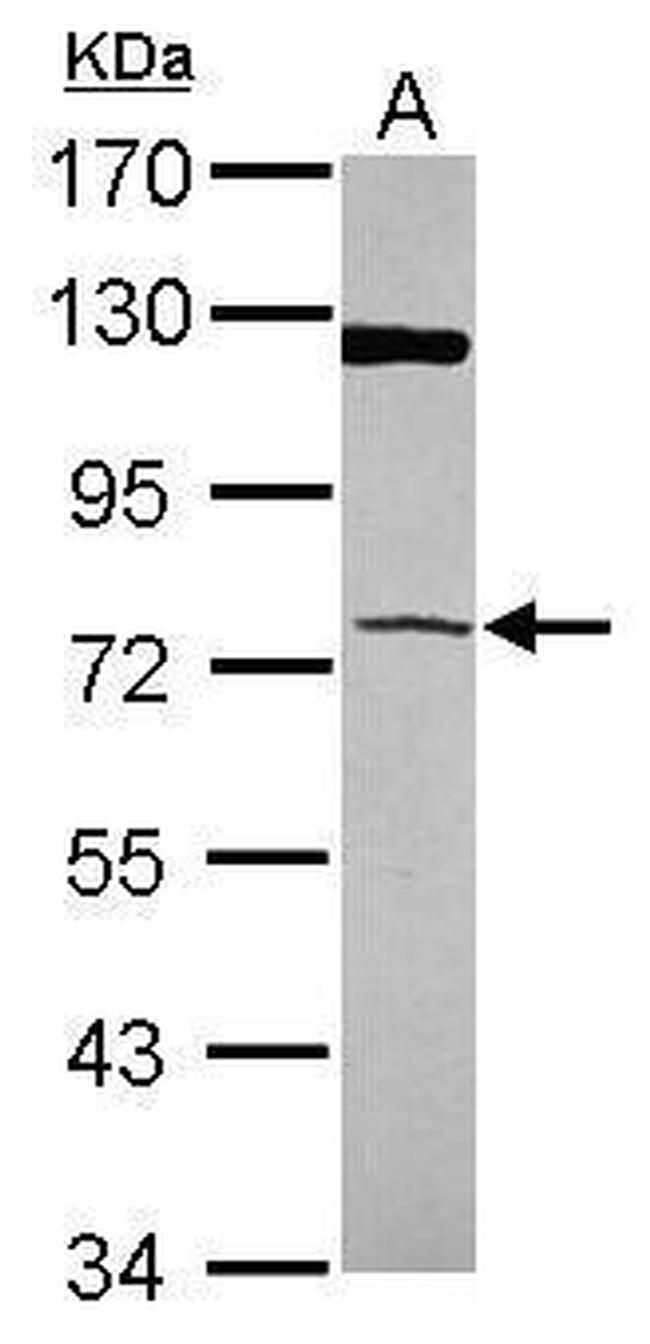 PAPSS1 Antibody in Western Blot (WB)