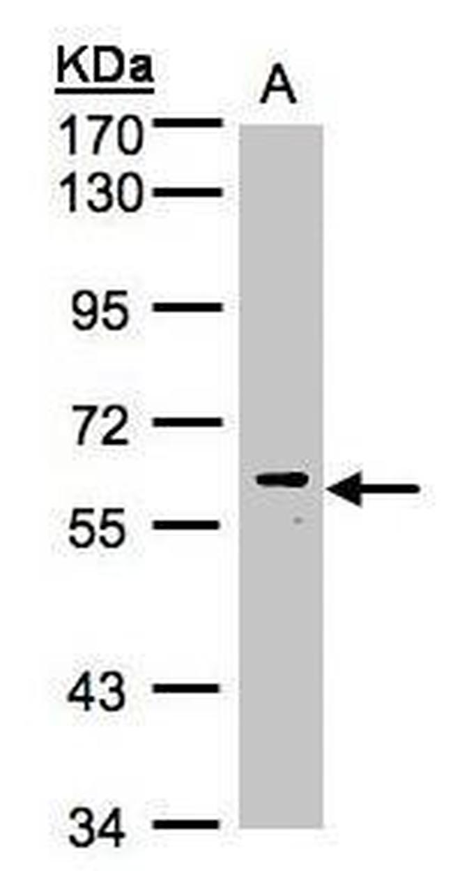 MAPK15 Antibody in Western Blot (WB)