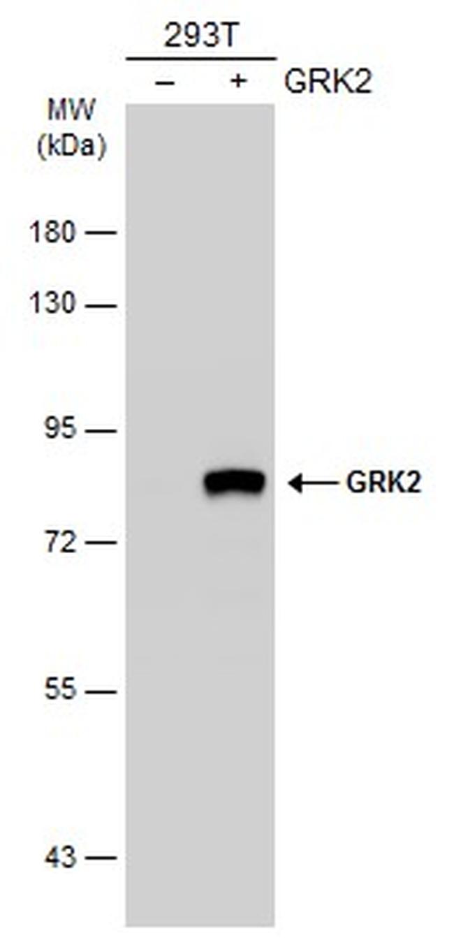 GRK2 Antibody in Western Blot (WB)