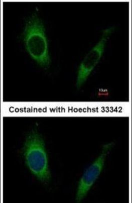 GRK2 Antibody in Immunocytochemistry (ICC/IF)