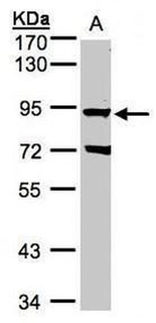 GRK2 Antibody in Western Blot (WB)