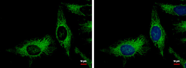 Adenylate Kinase 2 Antibody in Immunocytochemistry (ICC/IF)