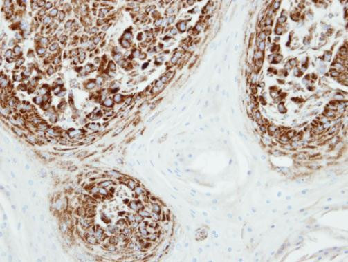 Adenylate Kinase 2 Antibody in Immunohistochemistry (Paraffin) (IHC (P))