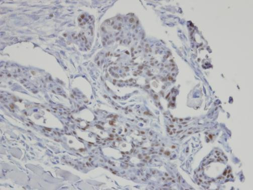 SART3 Antibody in Immunohistochemistry (Paraffin) (IHC (P))