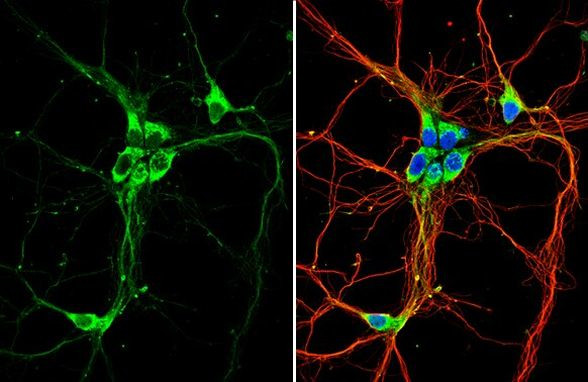 GPR30 Antibody in Immunocytochemistry (ICC/IF)