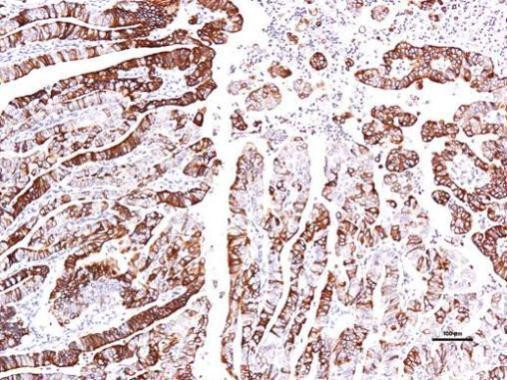 GPR30 Antibody in Immunohistochemistry (Paraffin) (IHC (P))