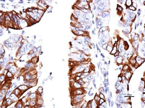 GPR30 Antibody in Immunohistochemistry (Paraffin) (IHC (P))