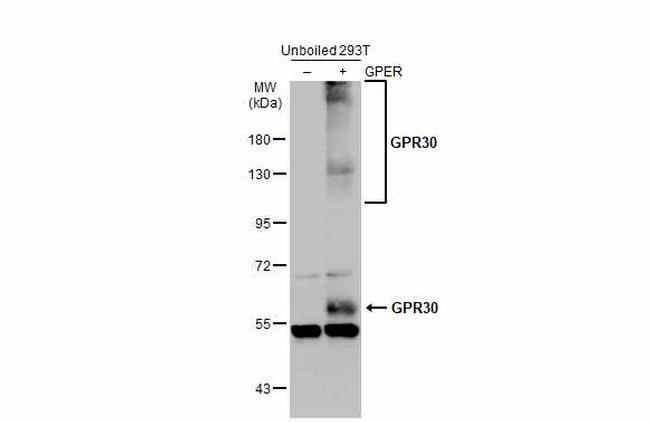 GPR30 Antibody in Western Blot (WB)