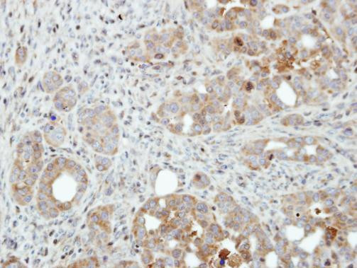 PFKFB4 Antibody in Immunohistochemistry (Paraffin) (IHC (P))