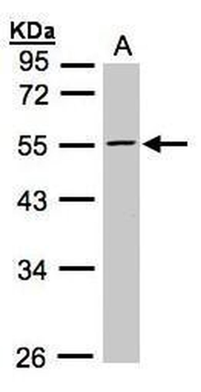 PFKFB4 Antibody in Western Blot (WB)