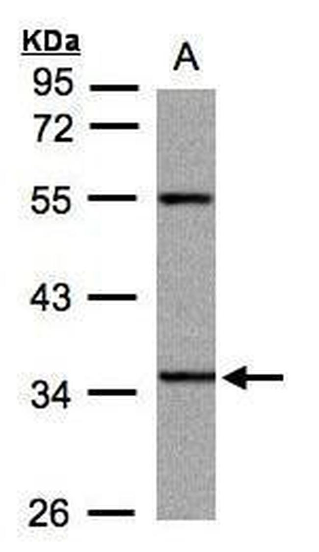 PANK3 Antibody in Western Blot (WB)