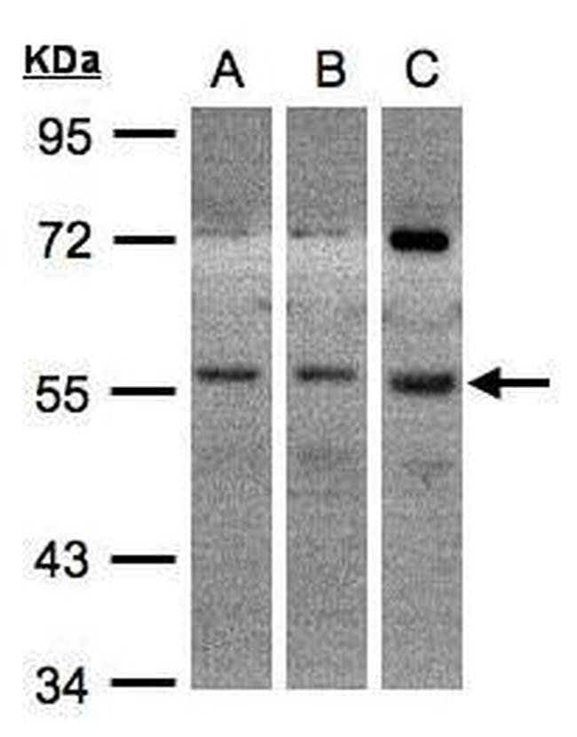 ADCK1 Antibody in Western Blot (WB)