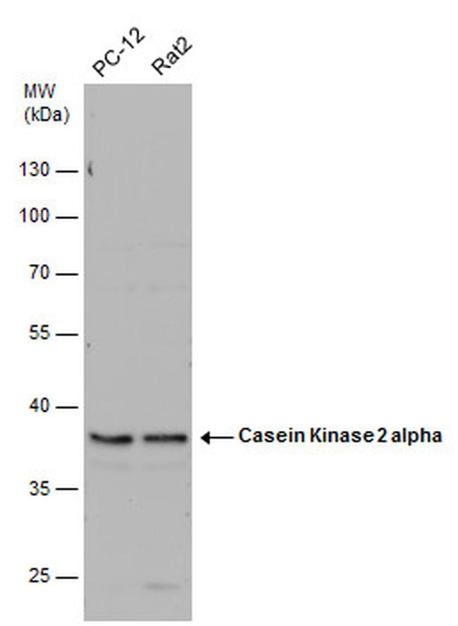 CK2 alpha-1 Antibody in Western Blot (WB)