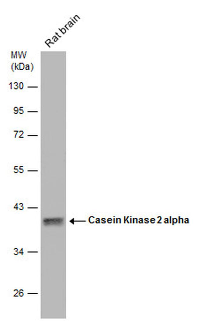 CK2 alpha-1 Antibody in Western Blot (WB)