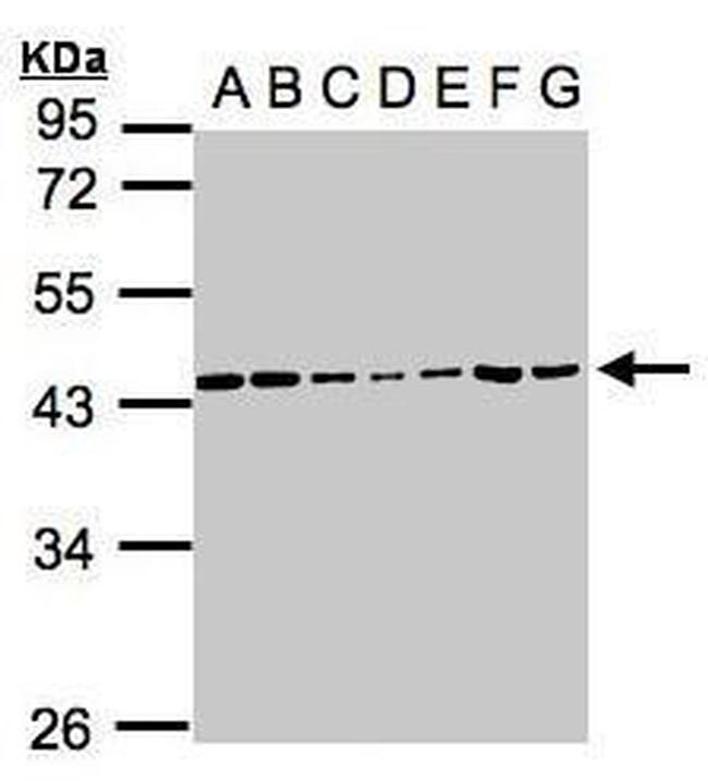 CK2 alpha-1 Antibody in Western Blot (WB)