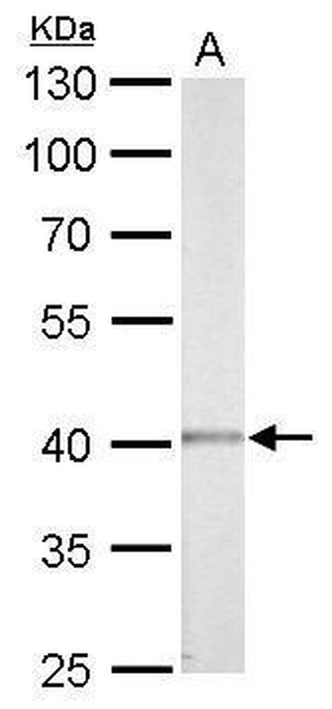 CK2 alpha-1 Antibody in Western Blot (WB)