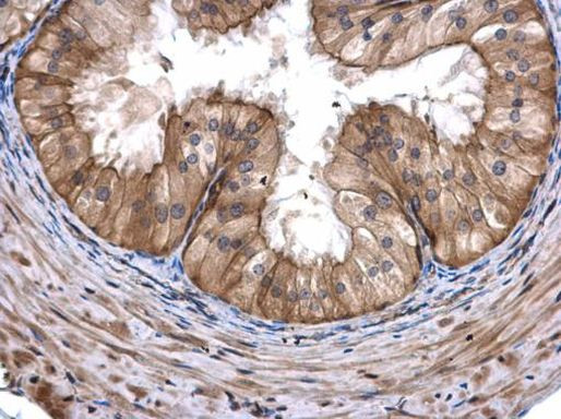 CoA Synthase Antibody in Immunohistochemistry (Paraffin) (IHC (P))