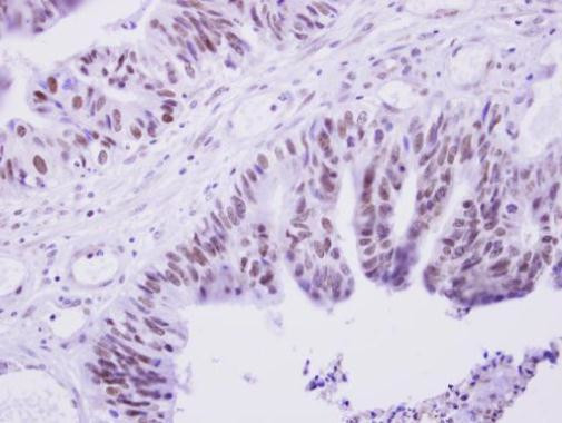 PRAM1 Antibody in Immunohistochemistry (Paraffin) (IHC (P))