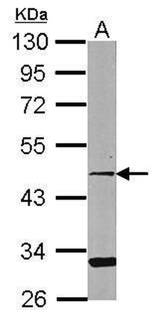 CCRL2 Antibody in Western Blot (WB)