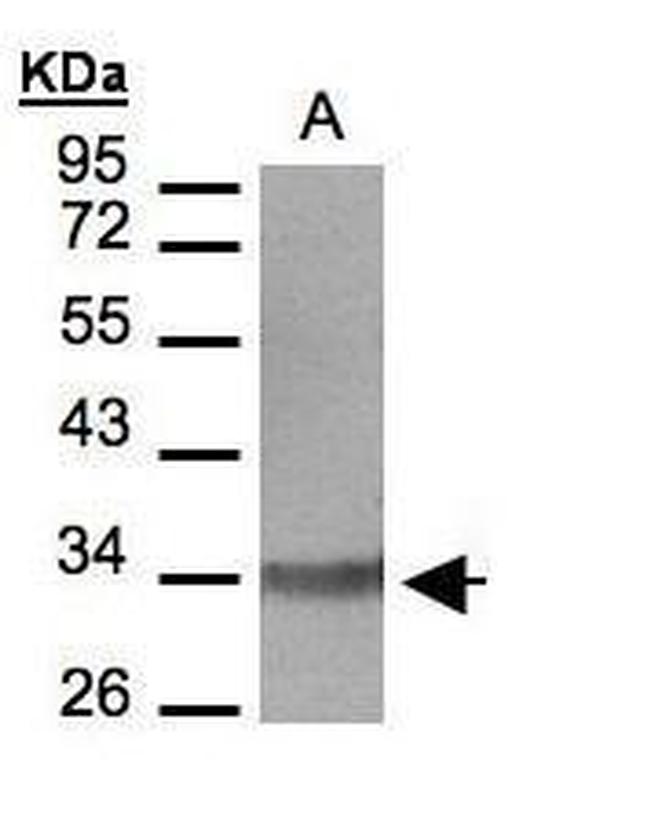 LTB4R Antibody in Western Blot (WB)
