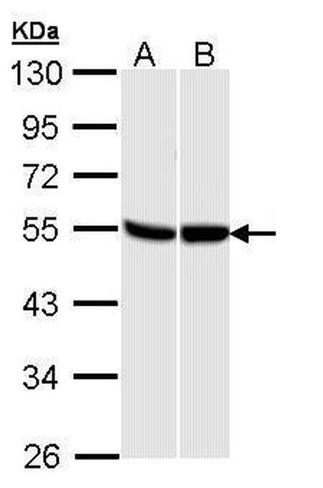 GPR87 Antibody in Western Blot (WB)