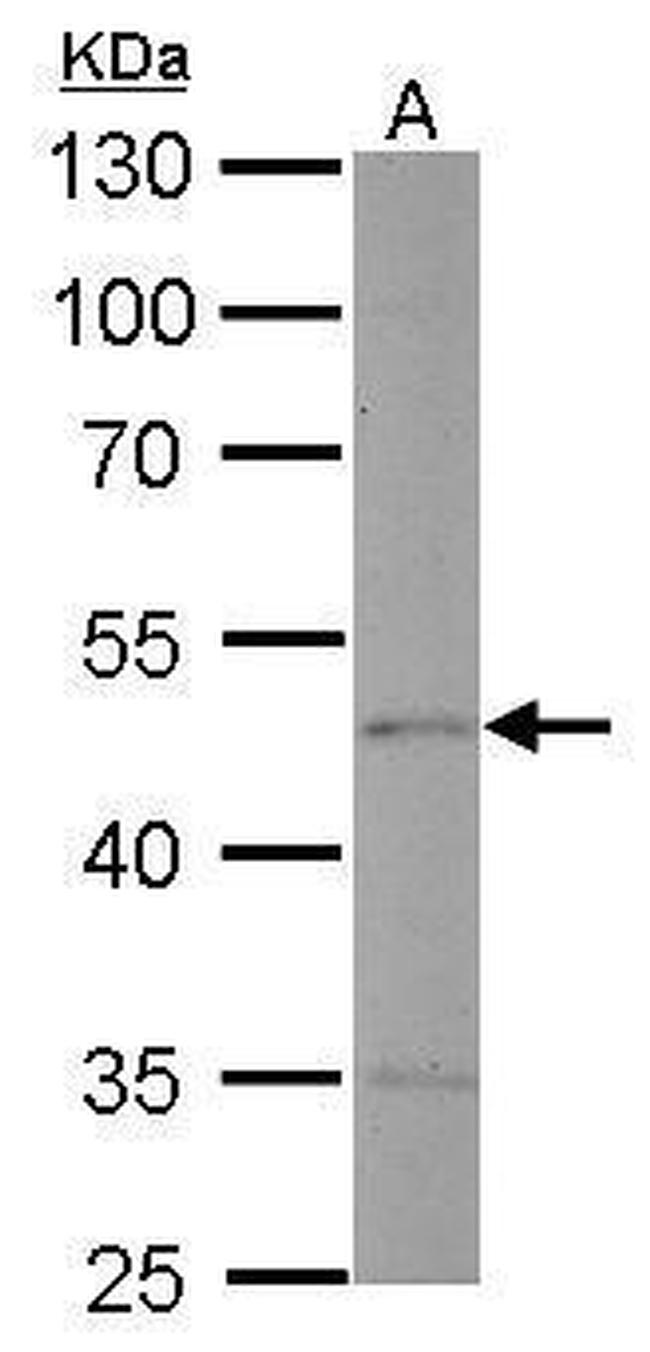 Endothelin B Receptor Antibody in Western Blot (WB)