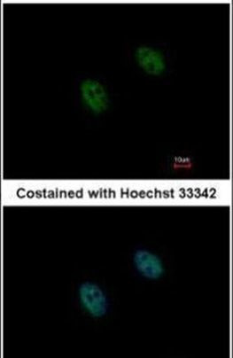 DUSP2 Antibody in Immunocytochemistry (ICC/IF)