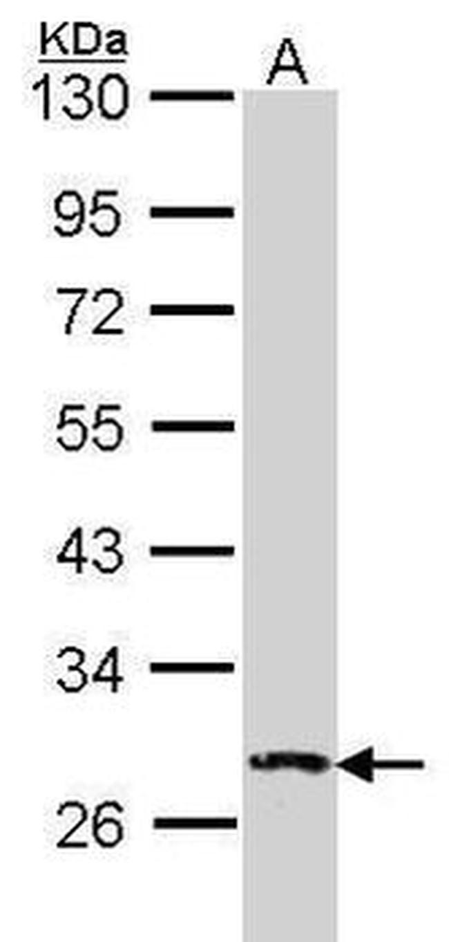 DUSP2 Antibody in Western Blot (WB)