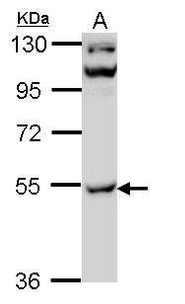 CaMKII gamma Antibody in Western Blot (WB)