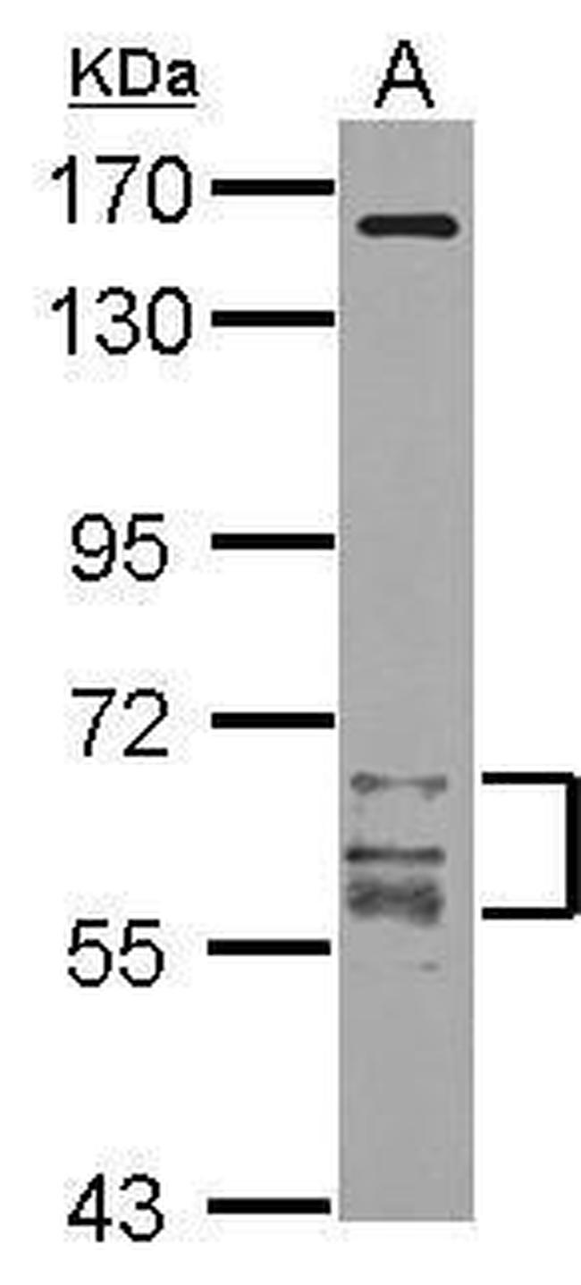 CaMKII gamma Antibody in Western Blot (WB)