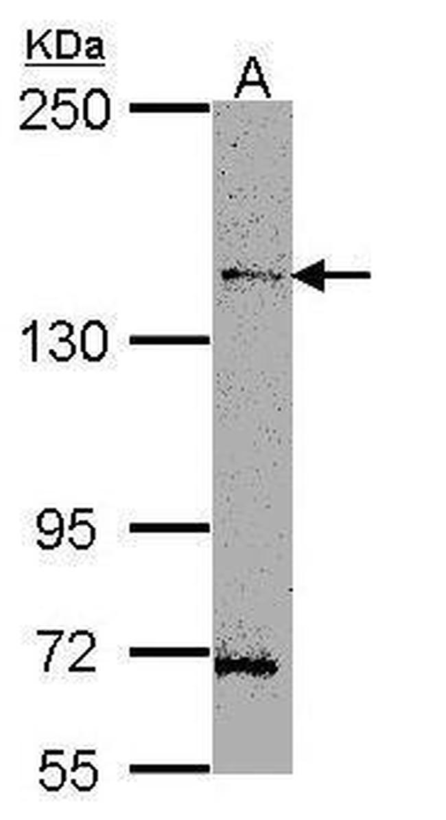 HIPK3 Antibody in Western Blot (WB)