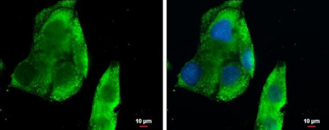 CXCL13 Antibody in Immunocytochemistry (ICC/IF)