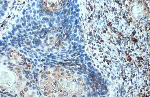 CXCL13 Antibody in Immunohistochemistry (Paraffin) (IHC (P))