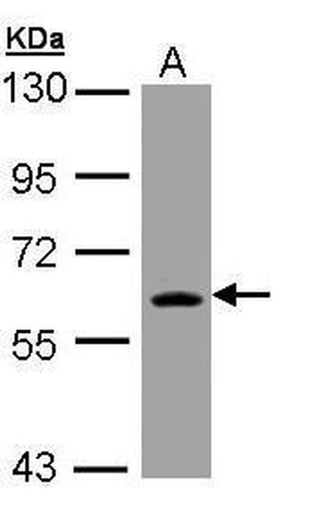 TrxR1 Antibody in Western Blot (WB)